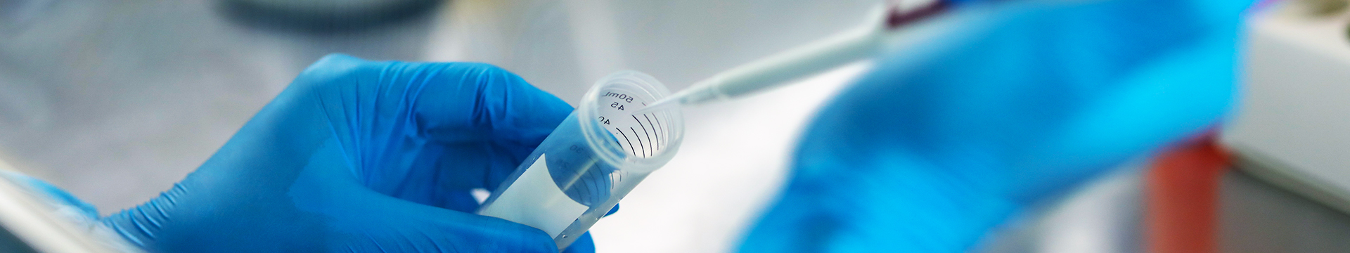 Pipetting and sample handling in the laboratory